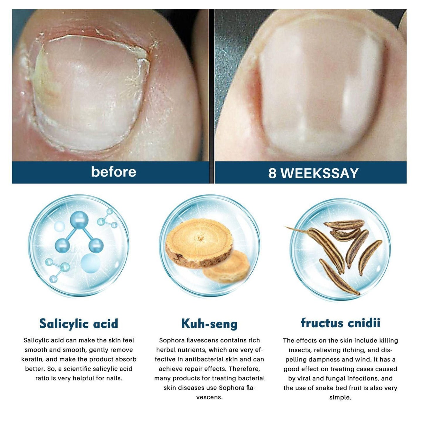 Nail Fungus Ointment