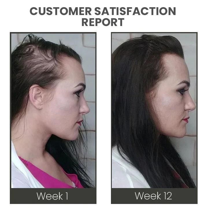 Hair Revival Boost Spray – Strengthen & Regrow Naturally