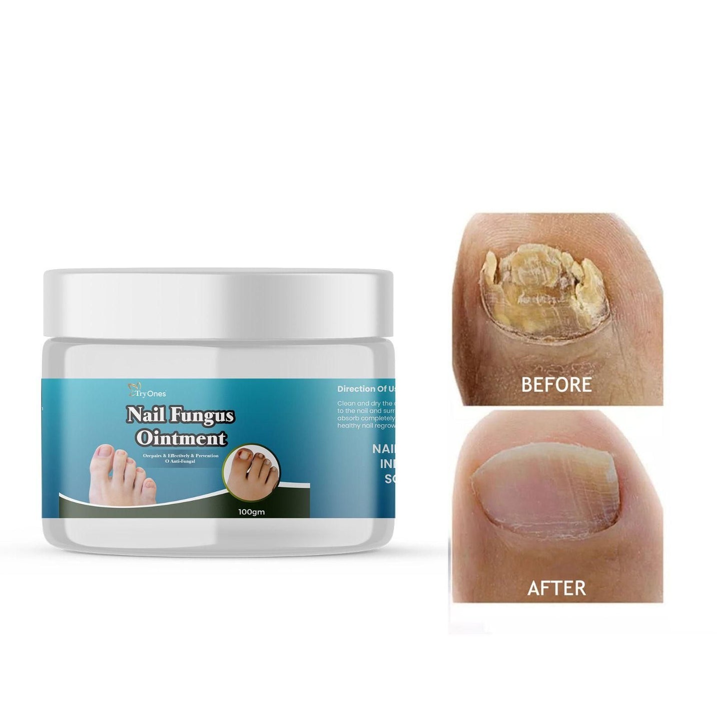 Nail Fungus Ointment