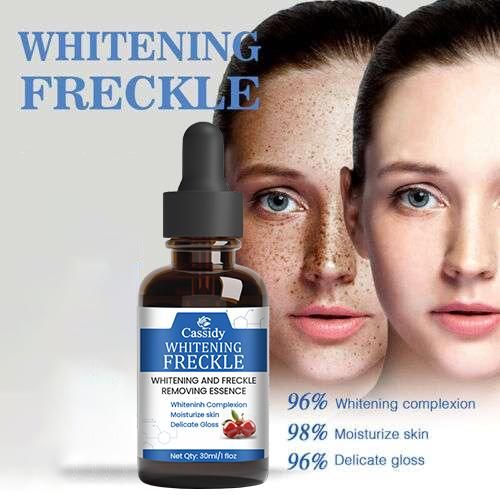 CASSIDY Whitening Frenkle  Removal Serum